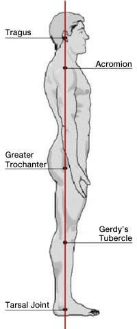 Standing-body alignment A) Lateral View-Good posture. B) Lateral